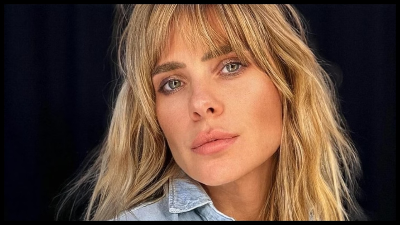 Carolina Dieckmann mostra machucados após acidente 1 carolina dieckmann mostra machucados apos acidente