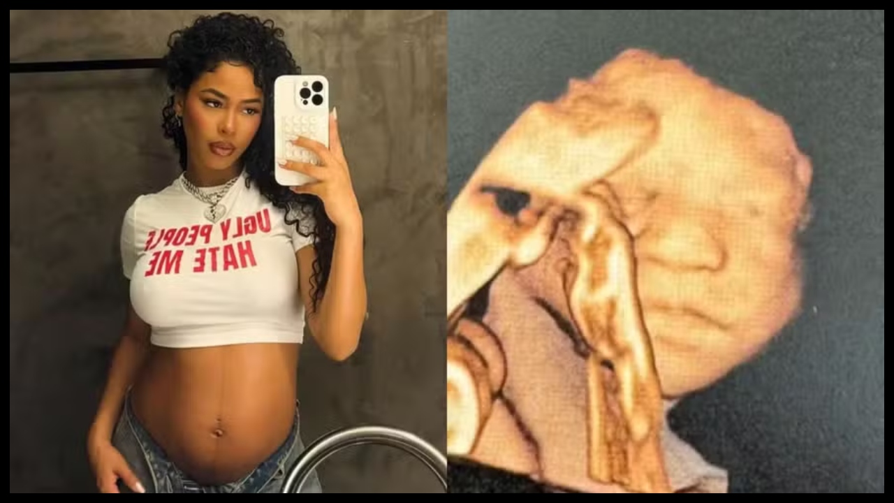 Lorena Maria publica ultrassom com rosto de seu filho 1 lorena maria publica ultrassom com rosto de seu filho